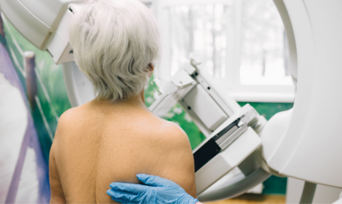 Free breast screening for more NZ women will categorically save lives